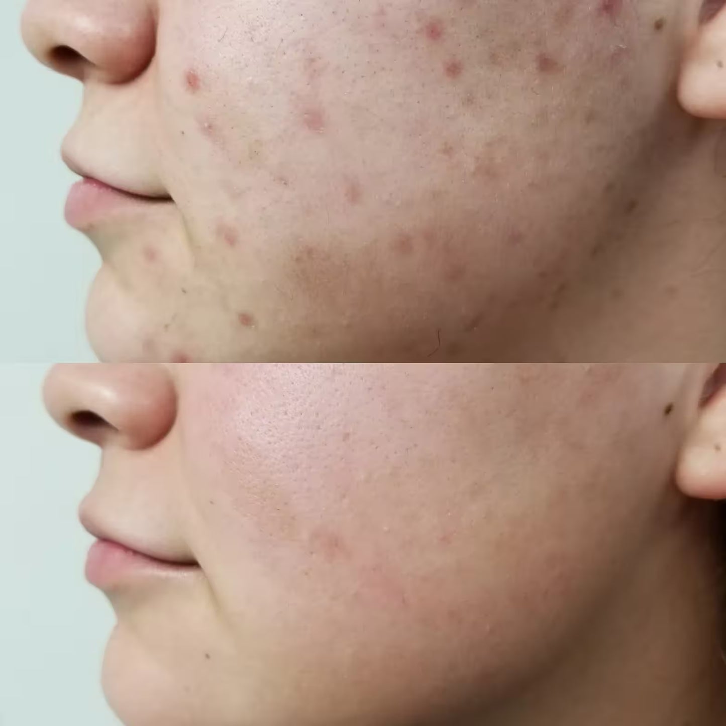 DR MELAXIN ANTI MANCHAS CREMA
