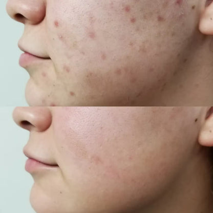 DR MELAXIN ANTI MANCHAS CREMA