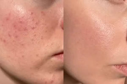 DR MELAXIN ANTI MANCHAS CREMA