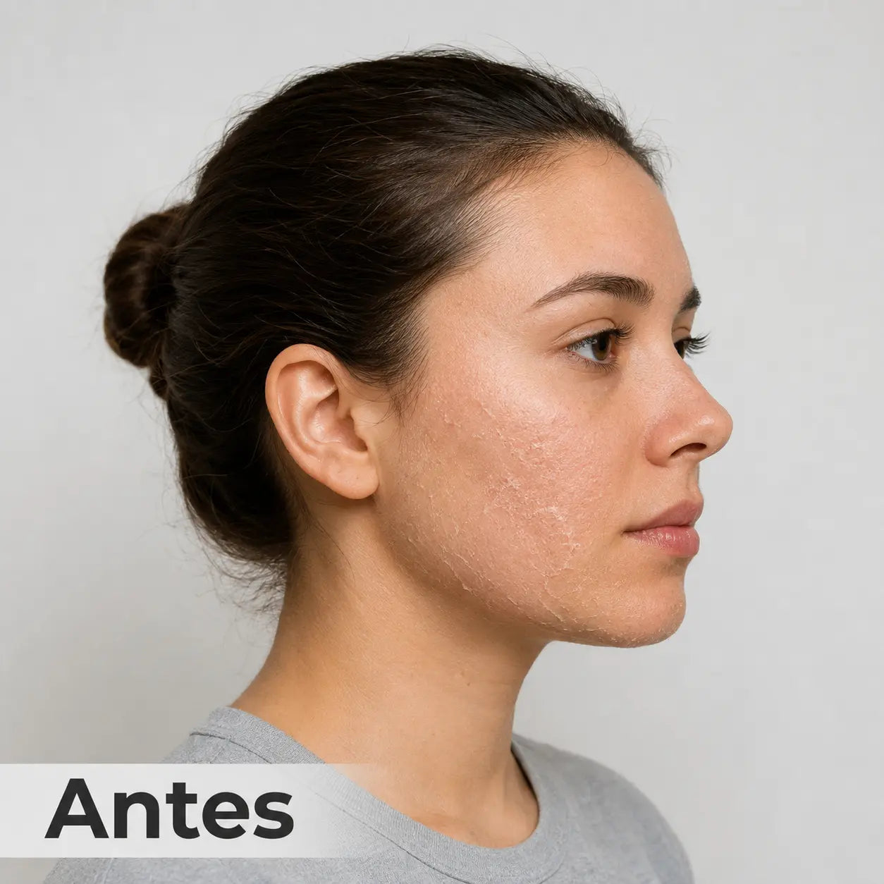 Antes