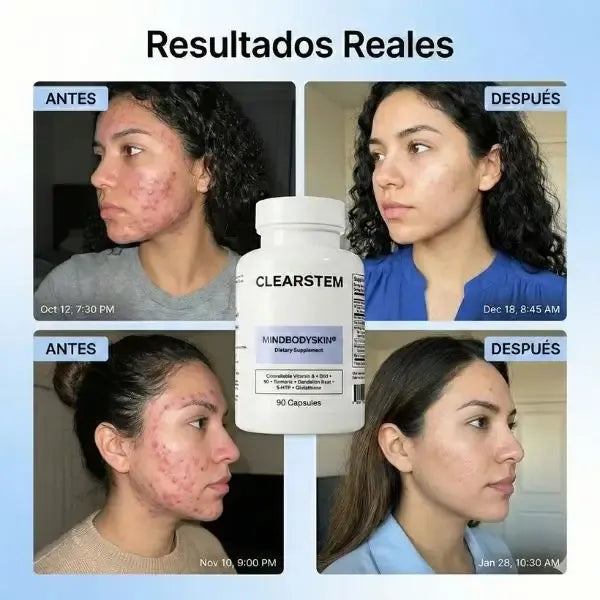 CLEARSTEM®