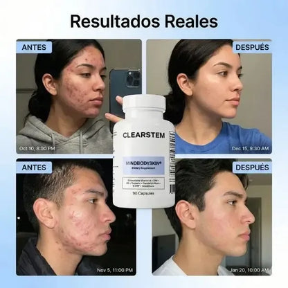 CLEARSTEM®
