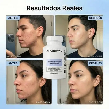 CLEARSTEM®